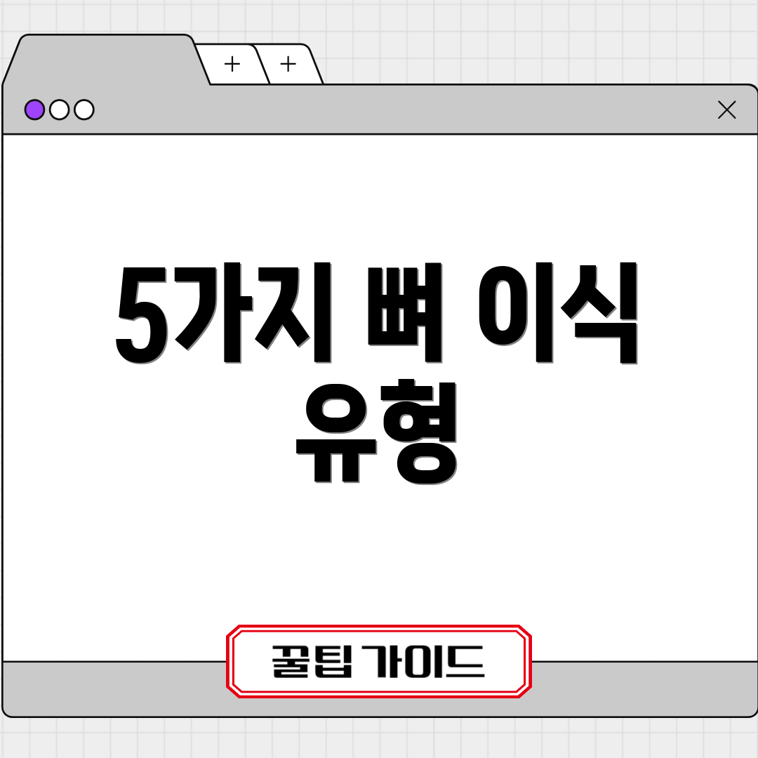 5가지 뼈 이식 유형